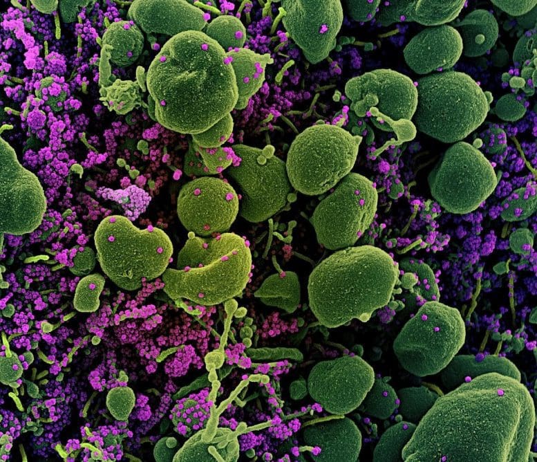 Apoptotic Cell SARS-CoV-2 Virus Particles