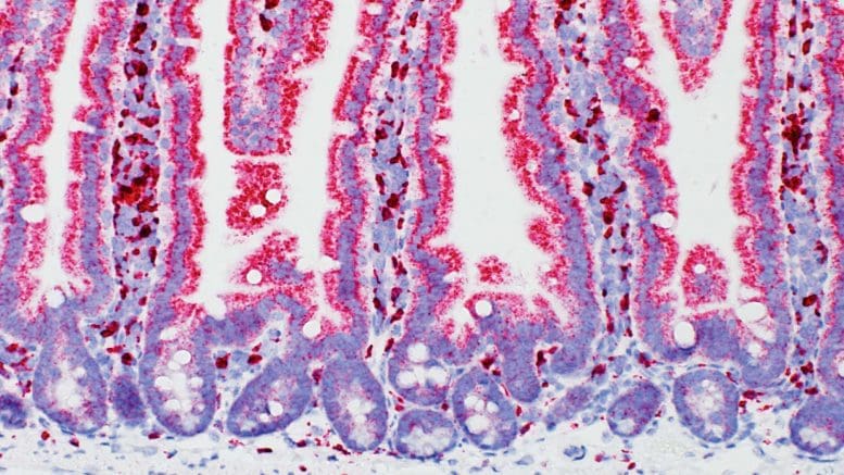 Normal Mouse Small Intestine