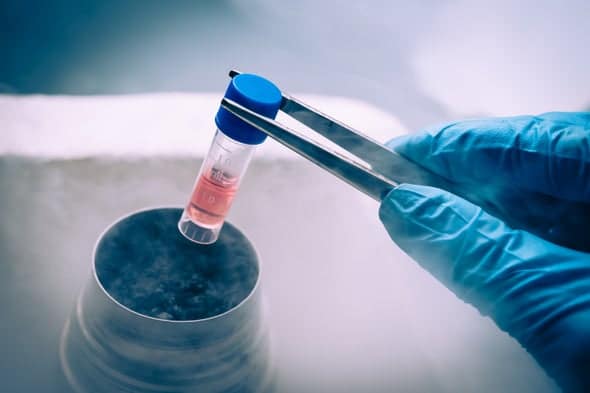 Stem cells – means of combating disease and aging (2)