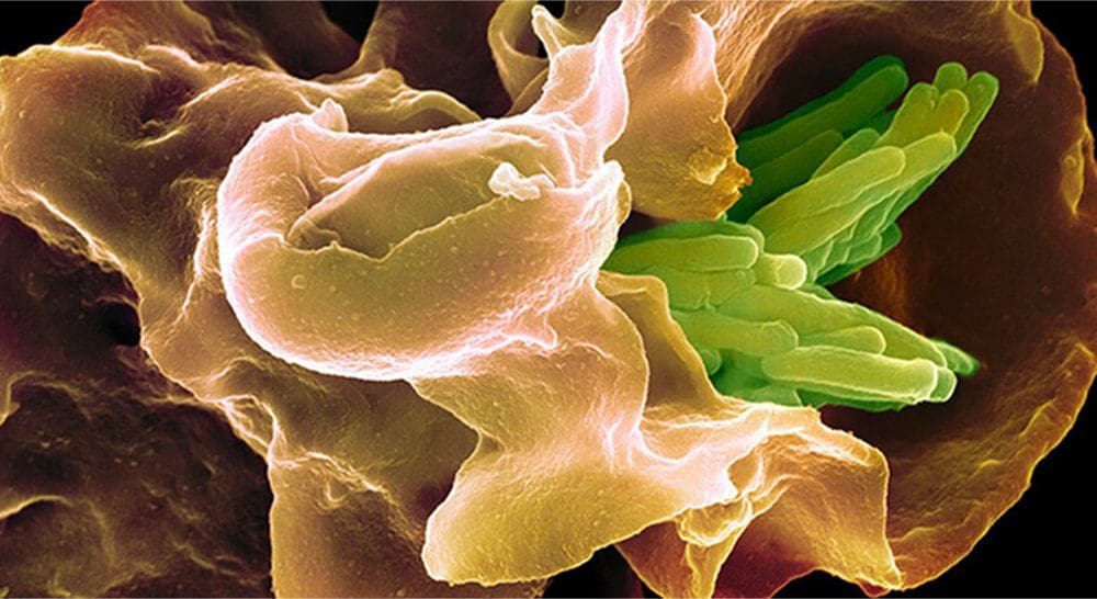 Tuberculosis remains one of the deadliest infectious