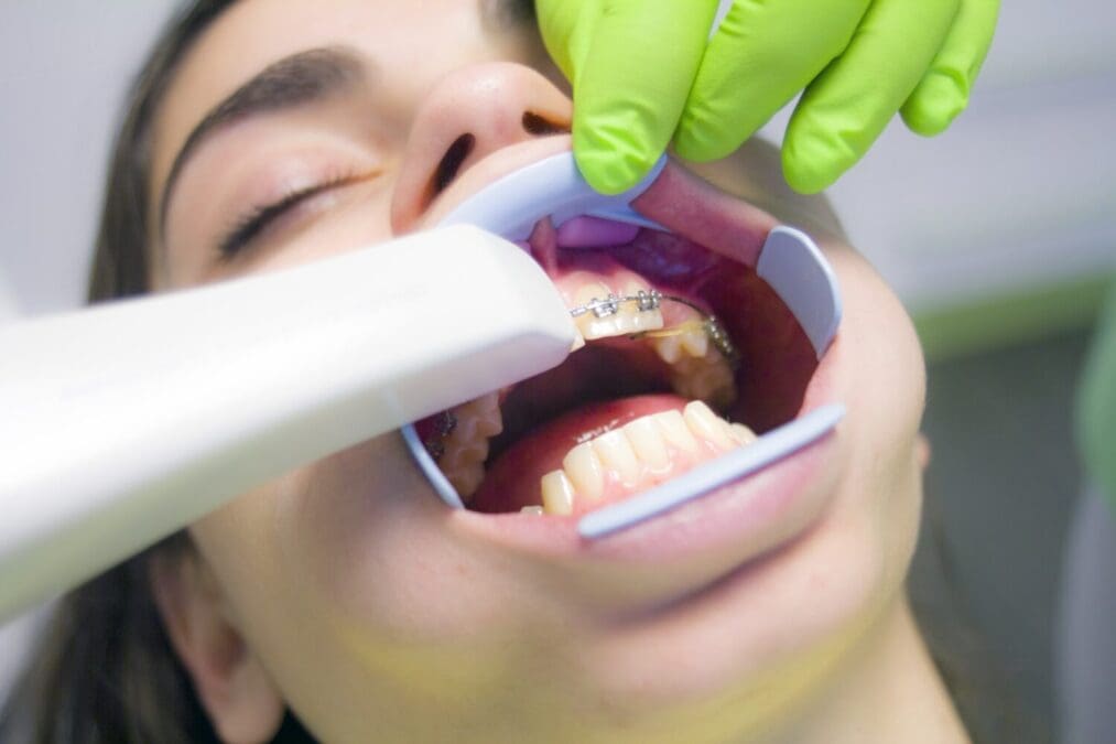 Greece’s “Dentist pass” – a mental health policy in disguise?